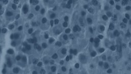 Film edukacyjny dotyczący polineuropatii dostępny