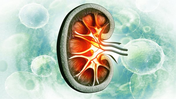 Gammapatie monoklonalne o znaczeniu nerkowym