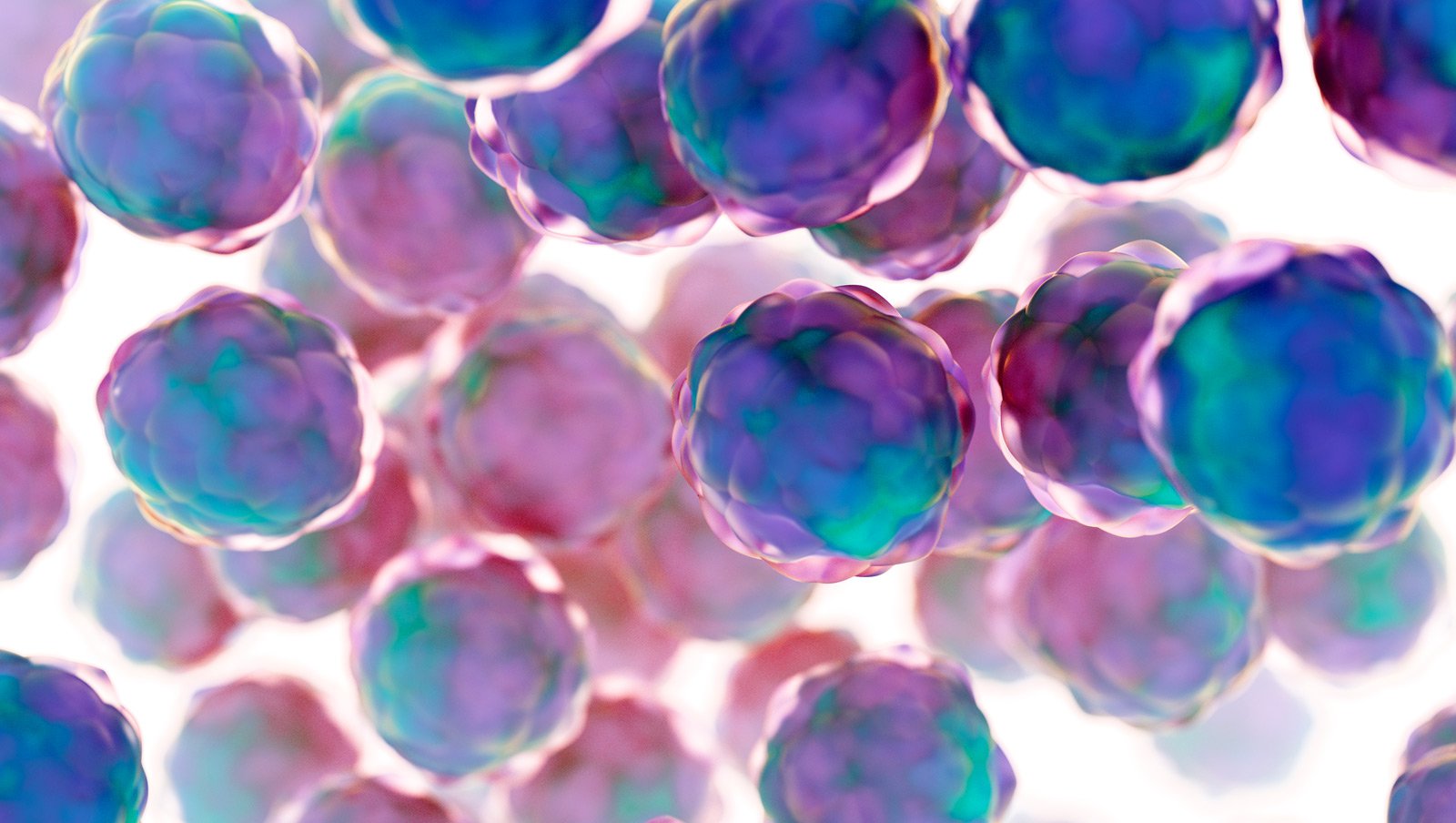 Choroba Gauchera – każdy hematolog może ją rozpoznać