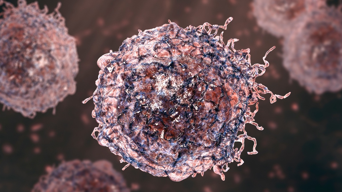 Znaczenie obecności klonu chłoniaka w krwi obwodowej w ziarniniaku grzybiastym i zespole Sezary’ego