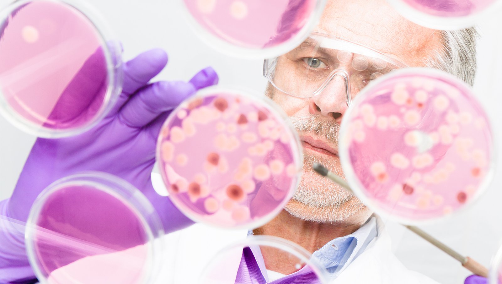 Powikłania infekcyjne - rzadsze oblicza grzybicy. Fuzarioza