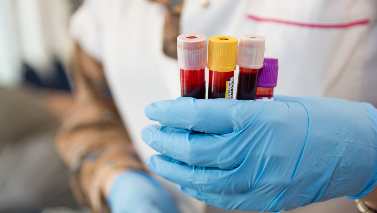 111 mln zł w dwa lata na hematologię. Powstaje pilotażowy program w ramach krajowej...