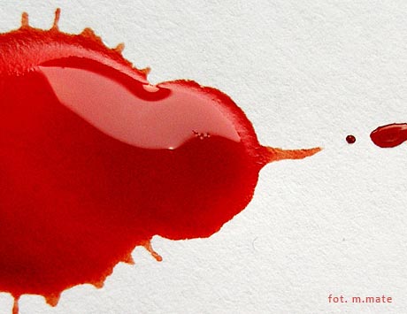 Profilaktyka trzeciorzędowa u chorych na hemofilię B w Kanadzie