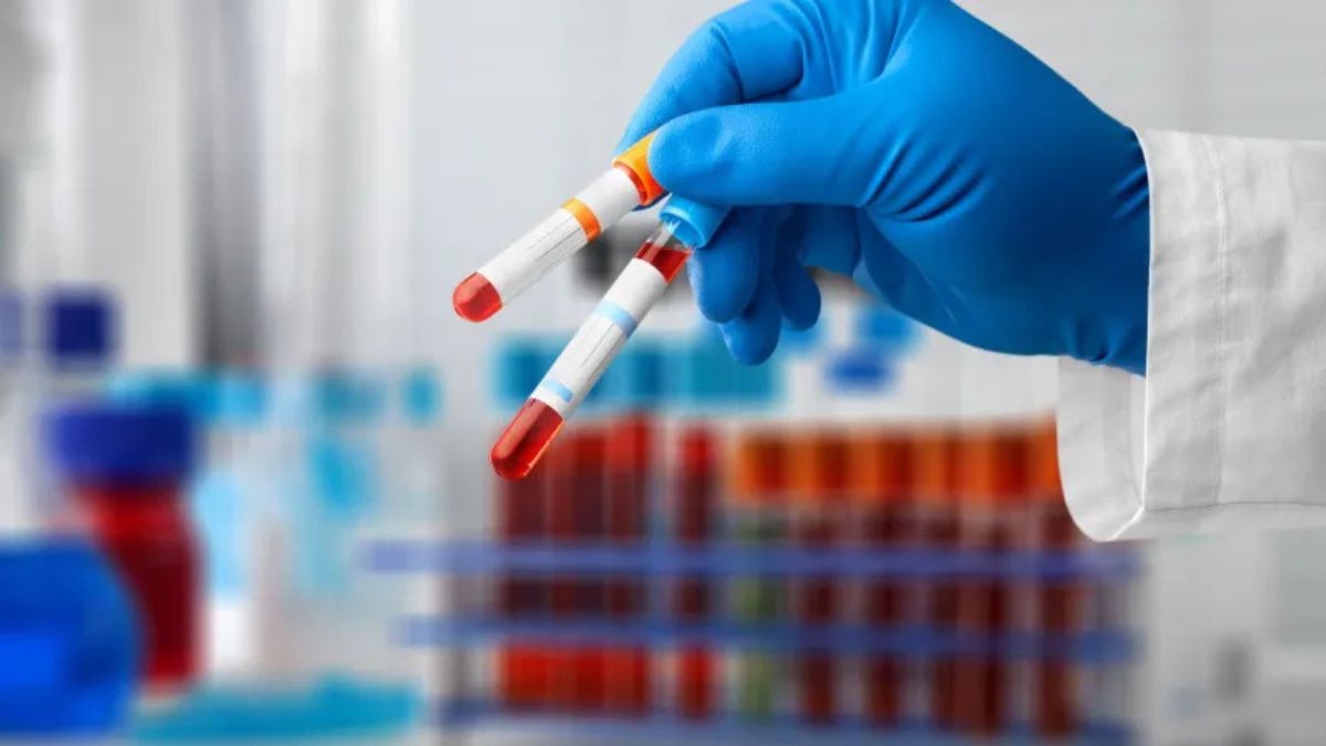 Hemofilia pod kontrolą. Jak działa ​Narodowy Program Leczenia Chorych na Hemofilię?