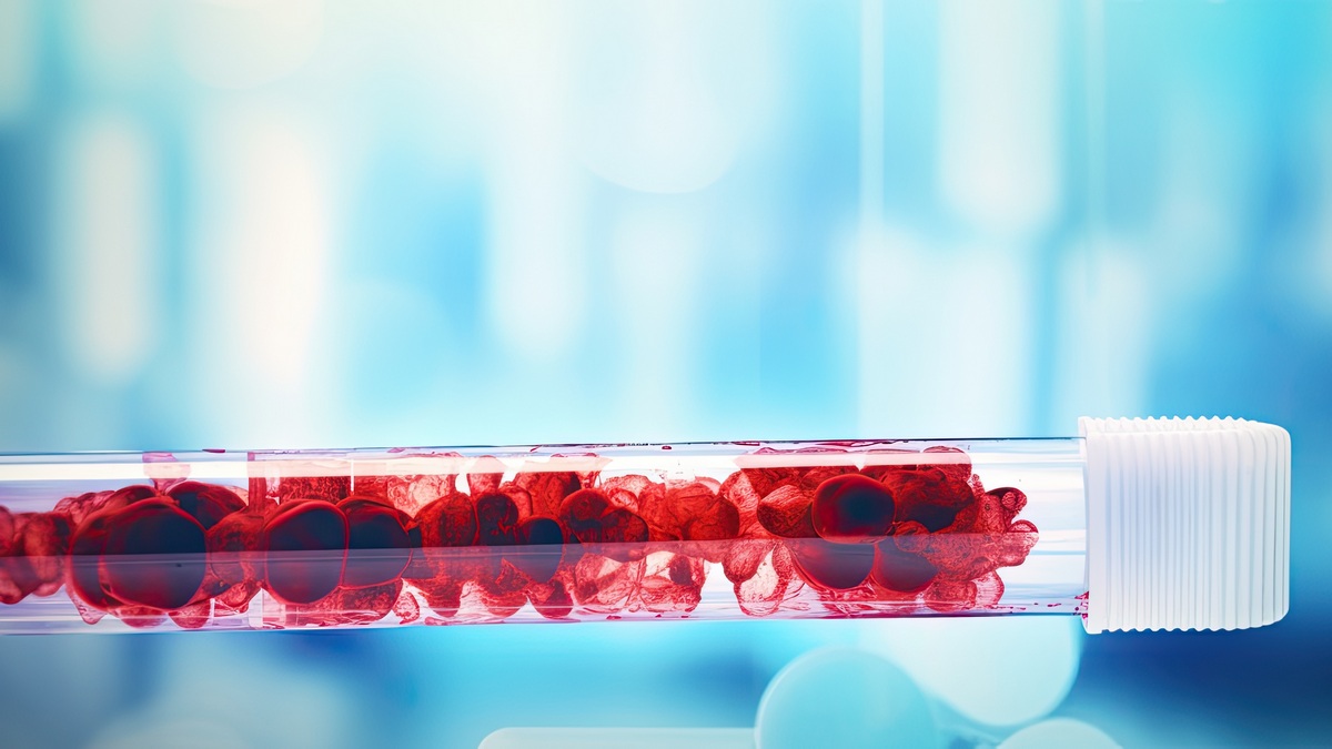 Weryfikacja nowych odczynników, kalibratorów i materiałów kontrolnych w badaniach hemostazy – wytyczne Międzynarodowej Rady ds. Standaryzacji w Hematologii