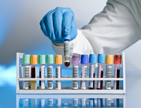 Obinutuzumab + chlorambucil  u chorych „slow –go” – wyniki badań wstępnych CLL11