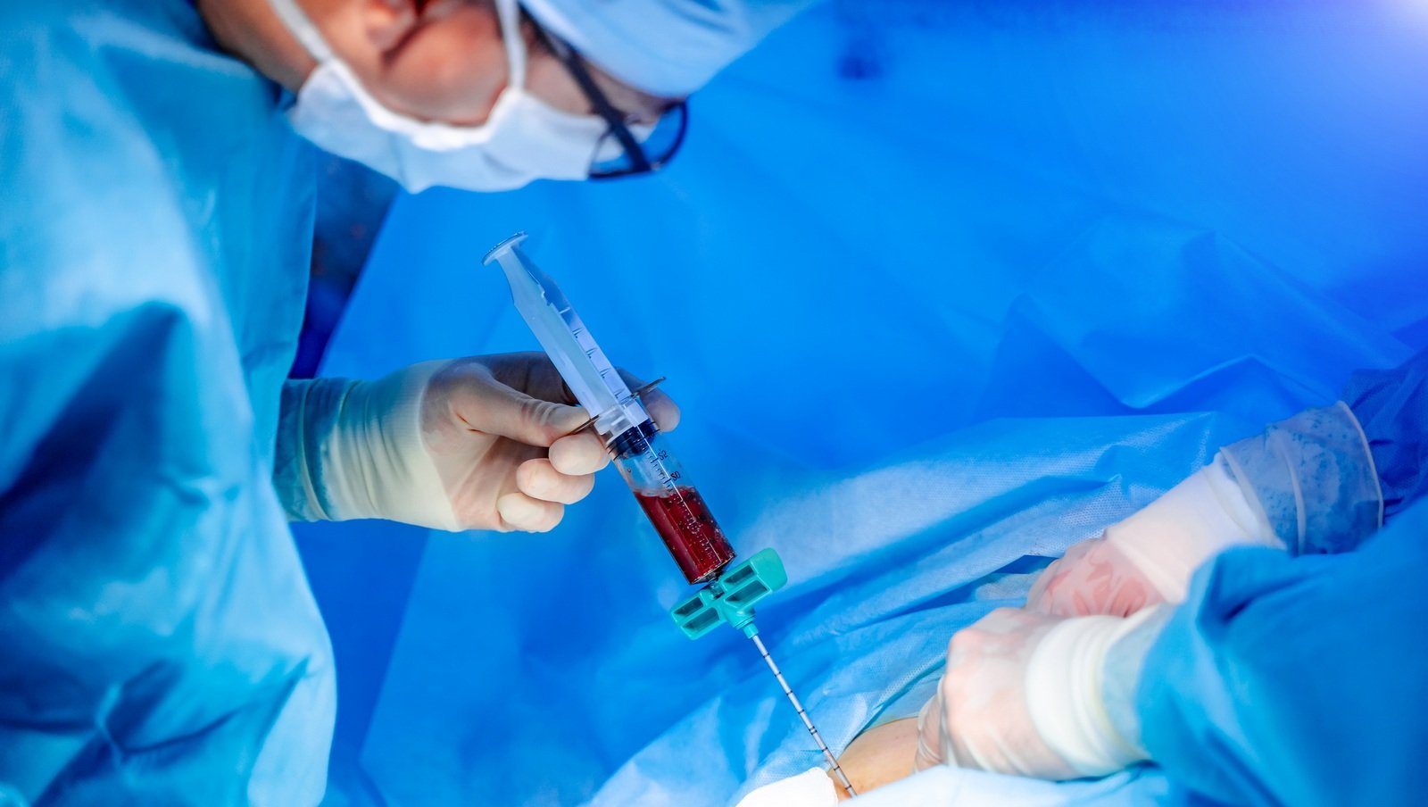 Indukcja daratumumabem, karfilzomibem, lenalidomidem i deksametazonem oraz konsolidacja...