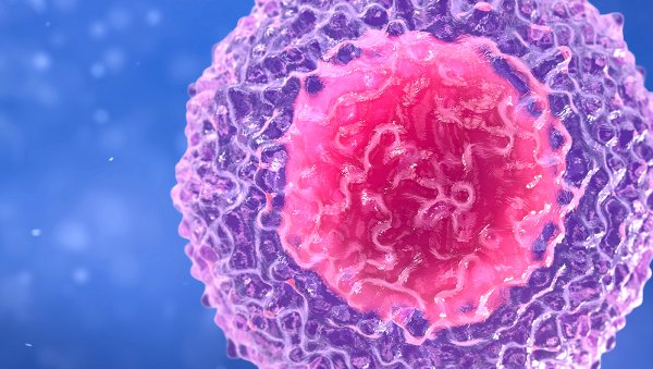 Infuzja limfocytów dawcy w przypadku nawrotów nowotworów hematologicznych po przeszczepieniu allogenicznych komórek krwiotwórczych od dawcy niespokrewnionego