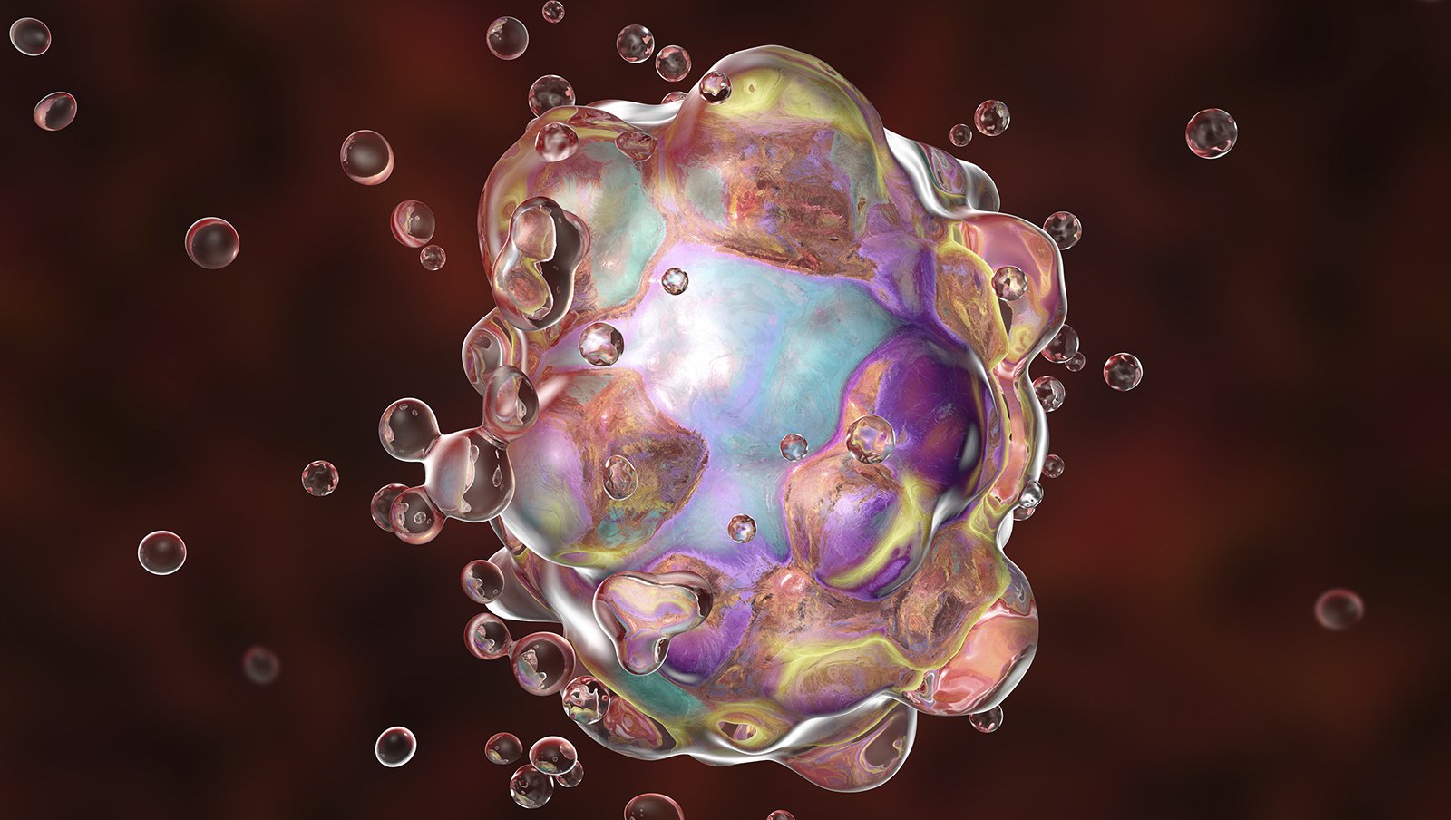 Efektywność terapii inhibitorami BTK u pacjentów z przewlekłą białaczką limfocytową...