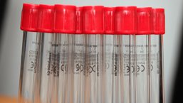 Inhibitory w hemofilii - wyniki analizy danych z rejestrów