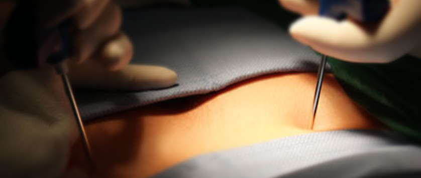 IV Międzynarodowa Konferencja Naukowo-Szkoleniowa „ Transplantacja komórek krwiotwórczych w leczeniu nowotworów mieloproliferacyjnych”, 10-11 października 2014, Poznań