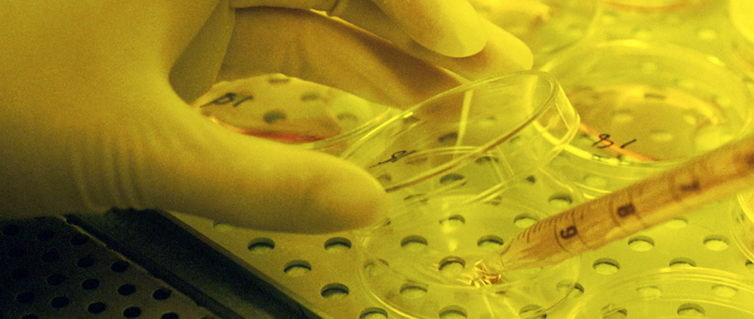 Komentarz doniesień z ASH 2014 dotyczących brentuximabu