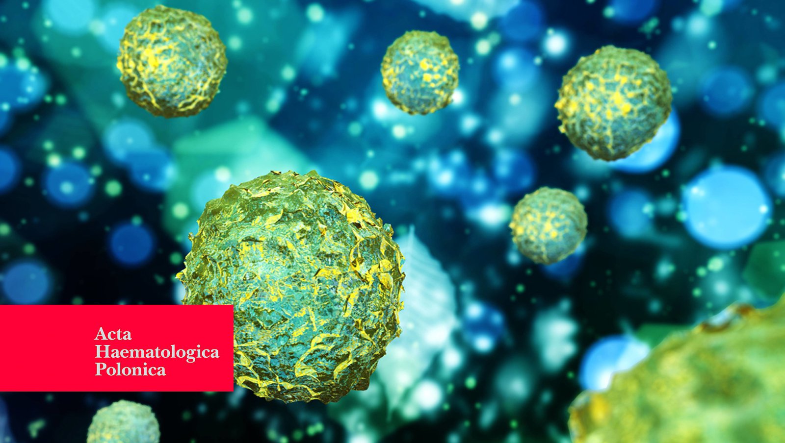 Transplantacja allogenicznych krwiotwórczych komórek macierzystych poprzedzona terapią ruksolitynibem u chorej na wtórną mielofibrozę molekularnie potrójnie ujemną