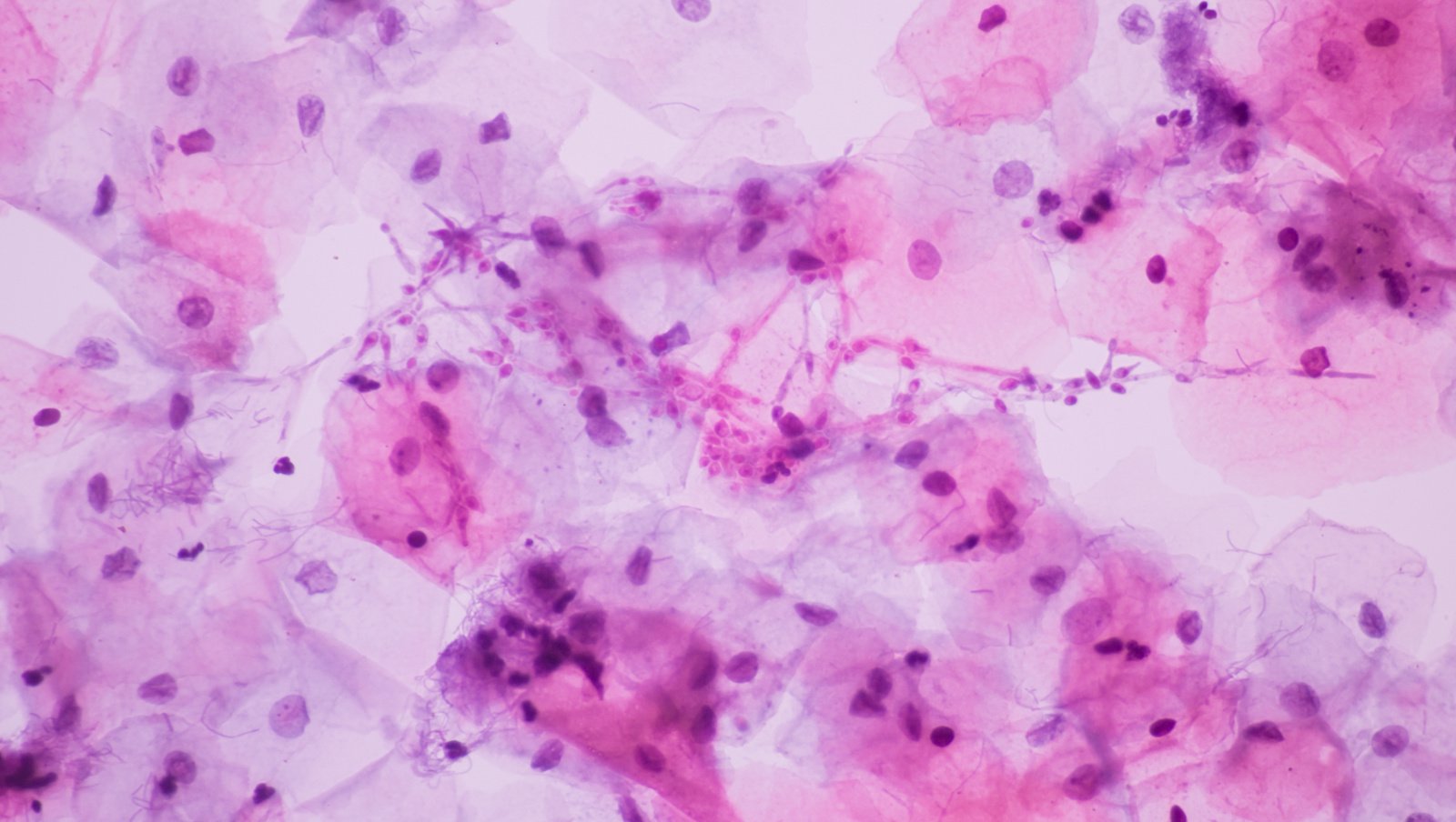 Niezbędnik hematologa, czyli najważniejsze interakcje – nowe leki celowane i profilaktyka...