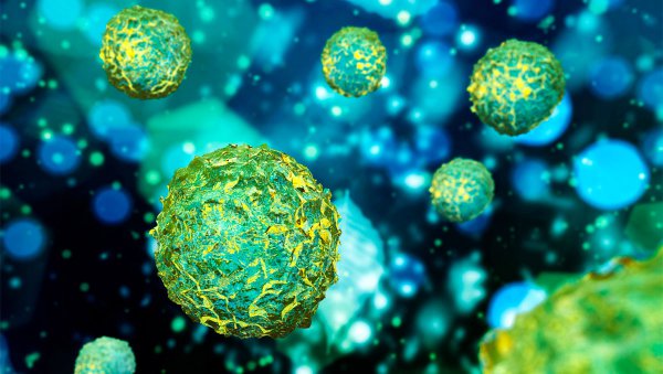 RIC i podwójna supresja limfocytów T z globuliną antytymocytarną i cyklofosfamidem potransplatacyjnym jako profilaktyka GVHD w haploPBSCT w nowotworach hematologicznych