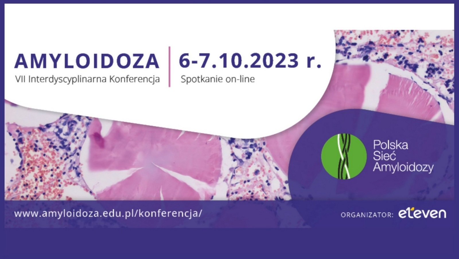 Relacja z VII Interdyscyplinarnej Konferencji "Amyloidoza"