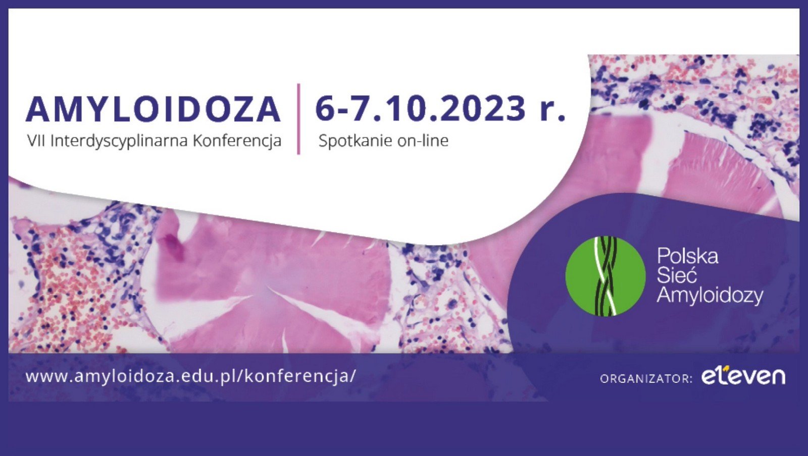 Amyloidoza. VII Interdyscyplinarna Konferencja | Zaproszenie