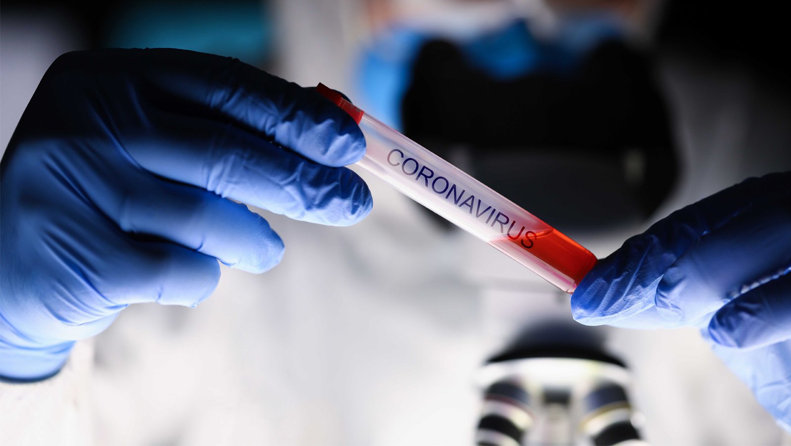 Objawy hematologiczne towarzyszące COVID-19 – na co zwrócić uwagę i u kogo podejrzewać...