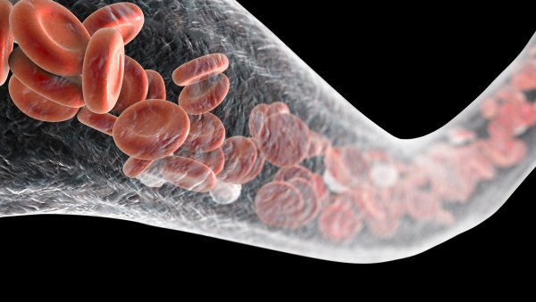 Krążące dsDNA, uszkodzenie śródbłonka i aktywacja dopełniacza w mikroangiopatii zakrzepowej i GVHD