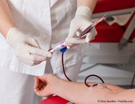 Allo-HSCT u chorych na nowotwory hematologiczne powyżej 70. roku życia