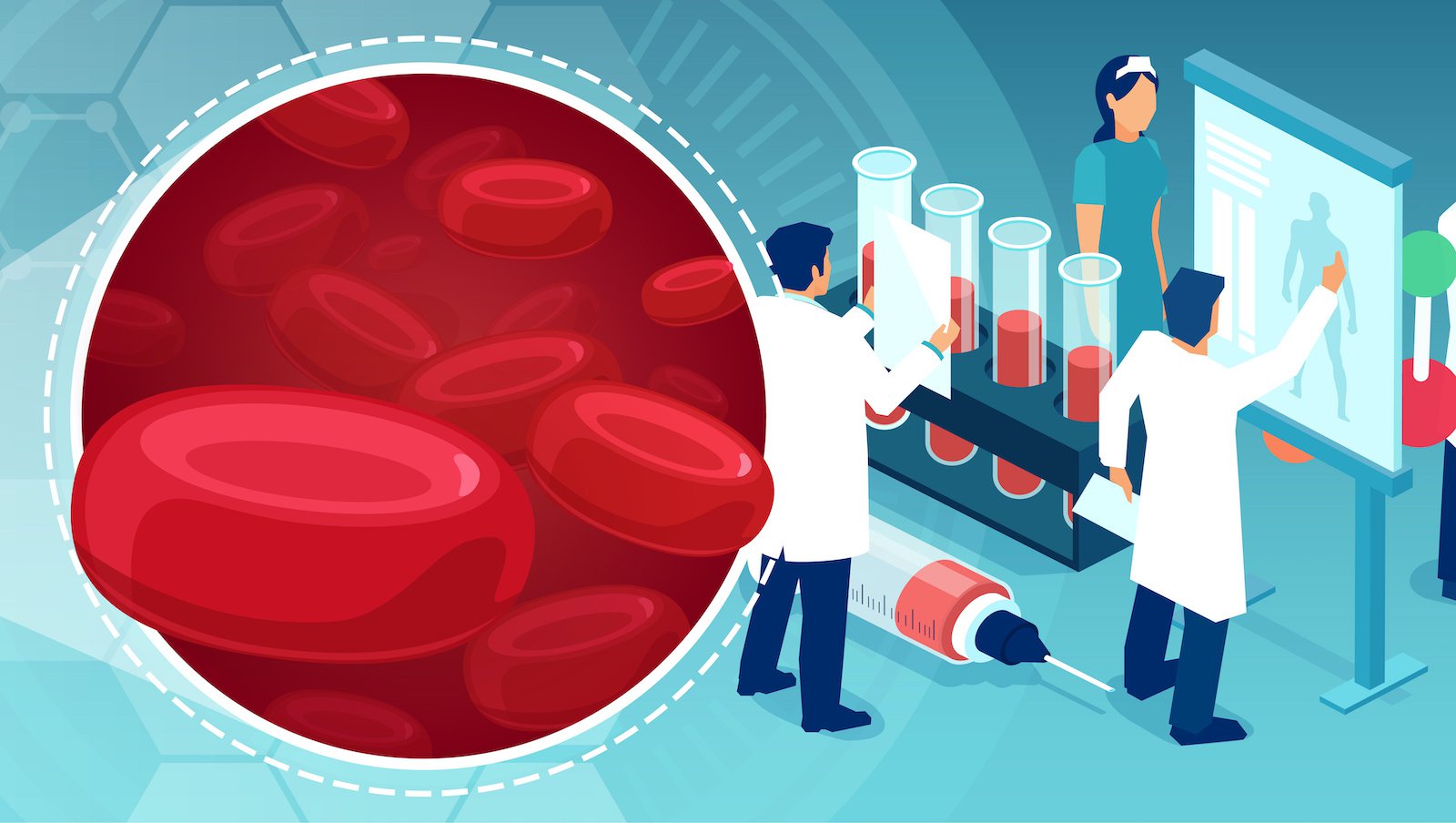 SUVmax w dniu 30 po terapii CAR-T jako nowy predyktor dalszych losów pacjentów z chłoniakiem z dużych rozlanych komórek B