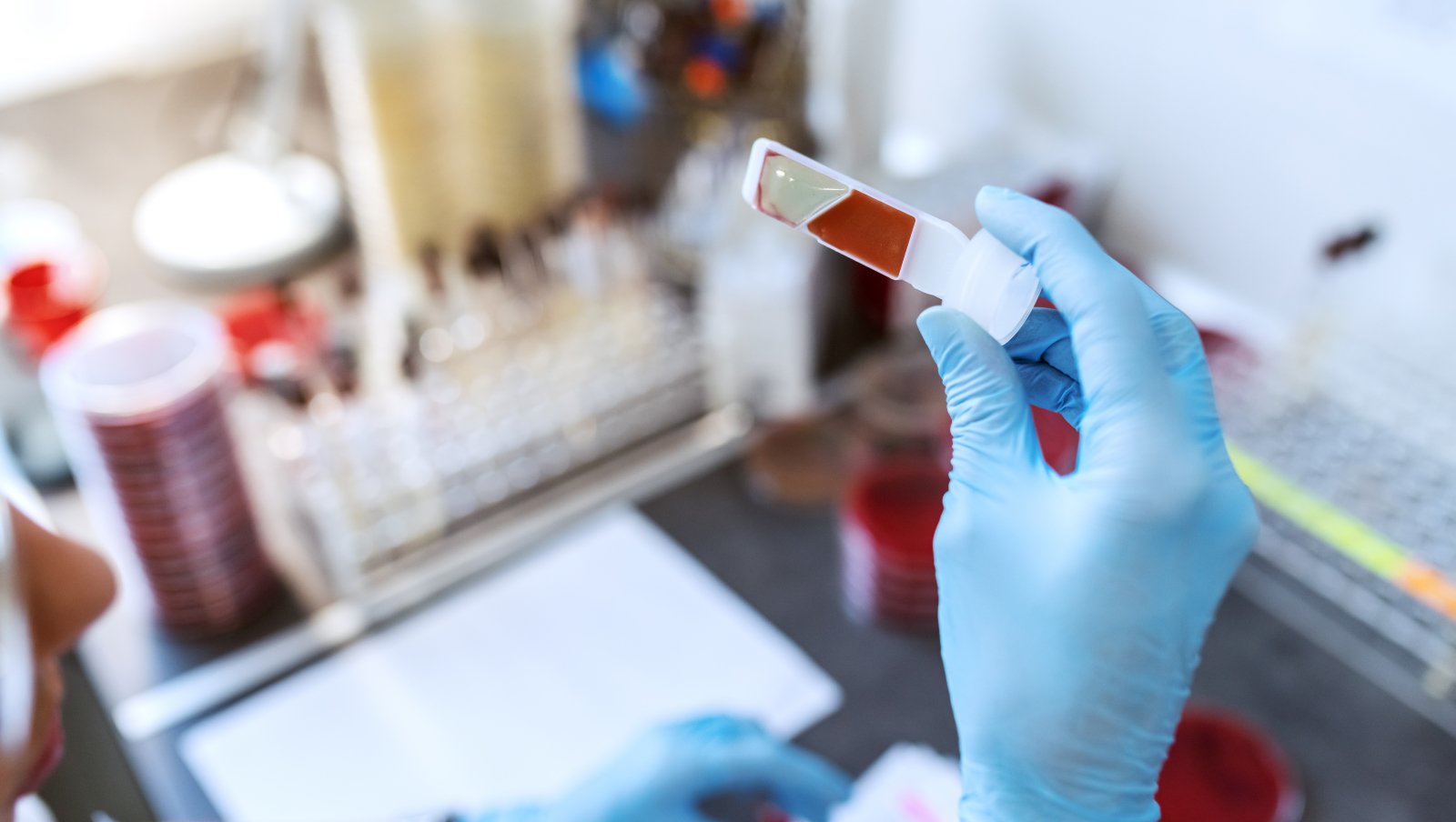 Przewlekła białaczka szpikowa. „Ośmielamy się mówić, że jesteśmy w stanie ją wyleczyć"