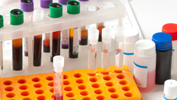 Leczenie chorych na zespoły mielodysplastyczne wyższego ryzyka po niepowodzeniu leczenia lekami hypometylującymi