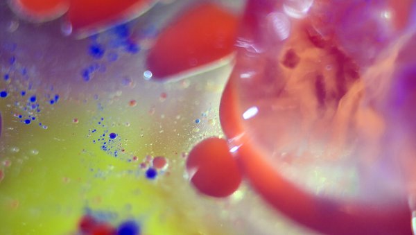 Leczenie skojarzone ibrutynibem oraz wenetoklaksem jako obiecująca opcja terapeutyczna nawrotowych i opornych przypadków chłoniaka z komórek płaszcza