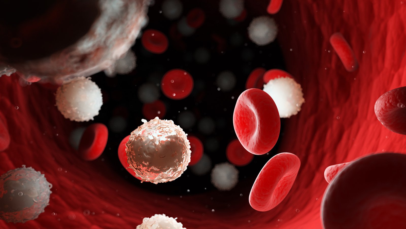 Chemioterapia czy allogeniczny przeszczep u pacjentów z ostrą białaczką limfoblastyczną...