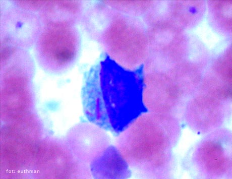 In Memoriam Profesor Janet Rowley & Profesor John Goldman - pożegnanie gigantów hematologii