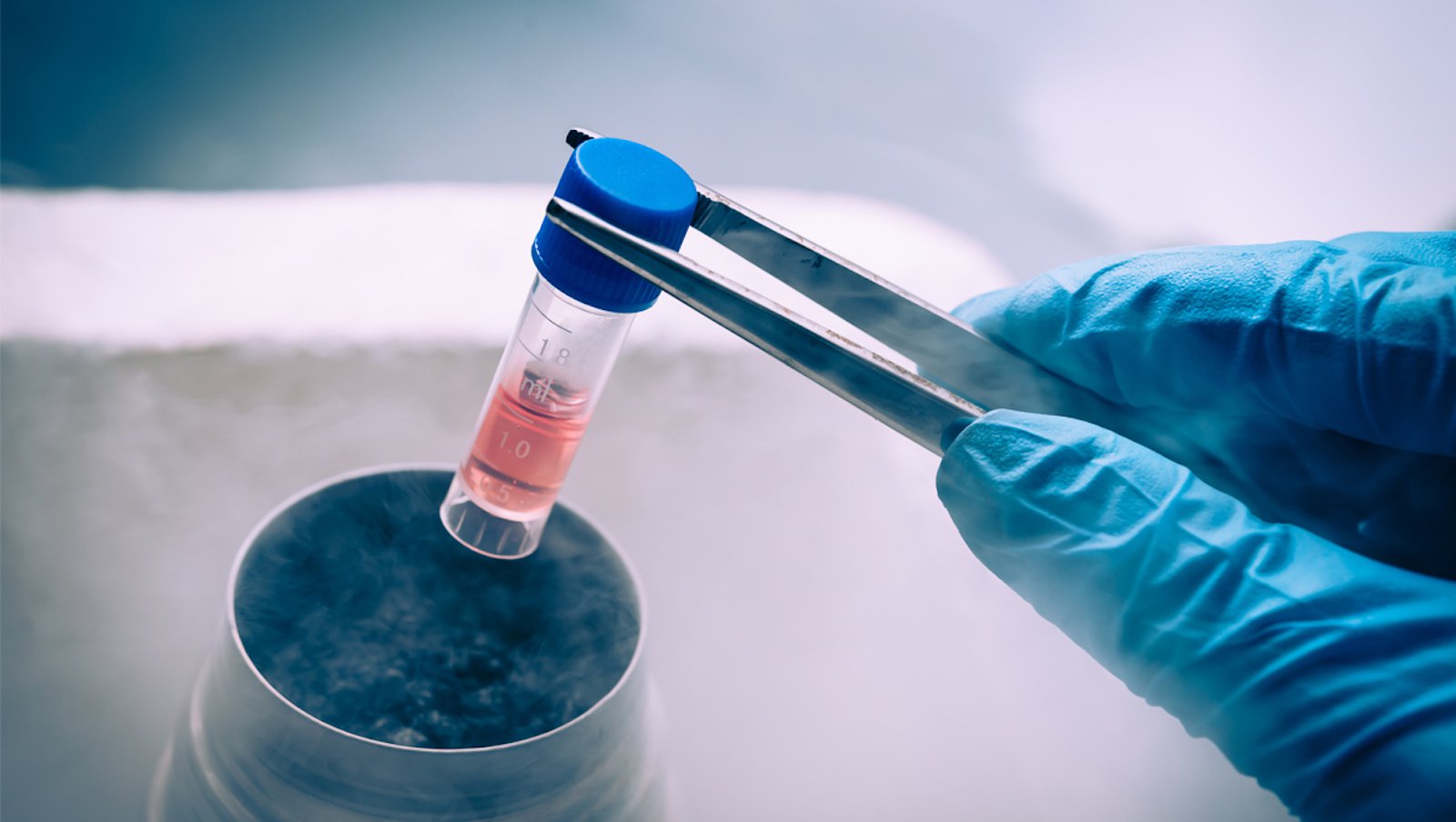 Przeszczepienie autologicznych krwiotwórczych komórek macierzystych  po terapii anty-PD-1 u chorych z nawrotowym/opornym chłoniakiem Hodgkina