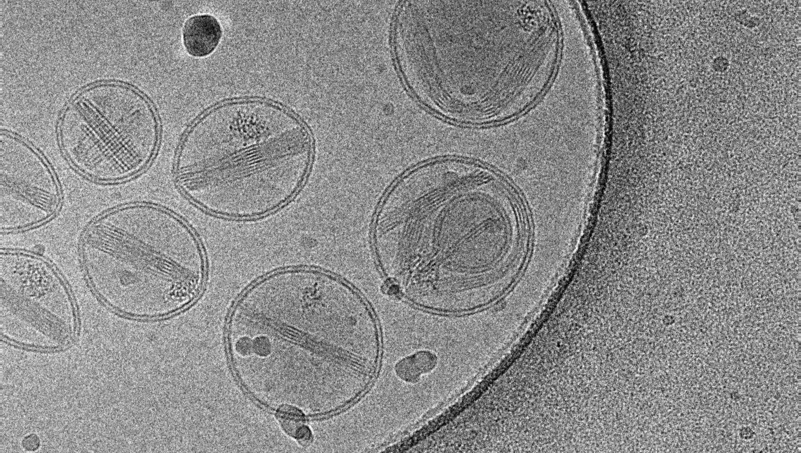 Makrofagi w niebezpieczeństwie – toksyczne nanocząsteczki?