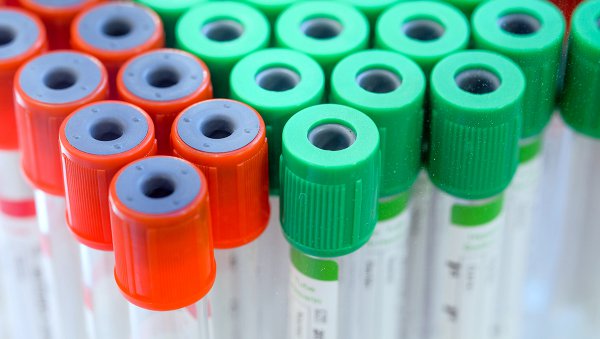 Małopłytkowość indukowana heparyną (HIT) u chorych w ciężkim stanie klinicznym
