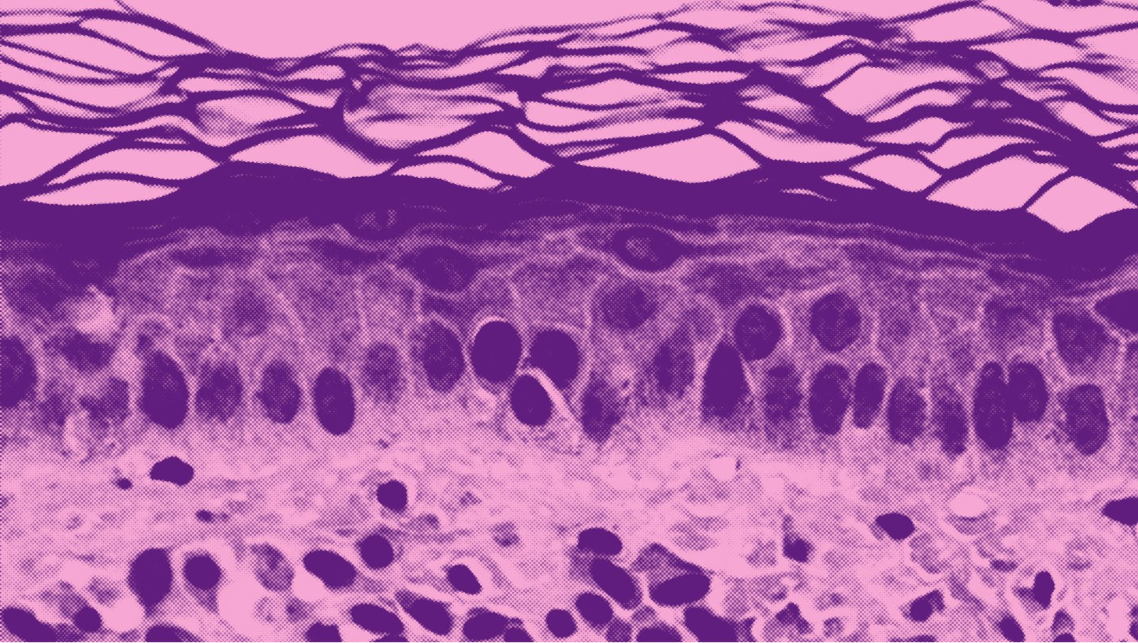 Mastocytoza | Znajomość objawów kluczowa dla wczesnej diagnostyki