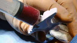 Mobilizacja autologicznych krwiotwórczych komórek macierzystych z zastosowaniem pleryksaforu - na podstawie doniesień z EHA 2015