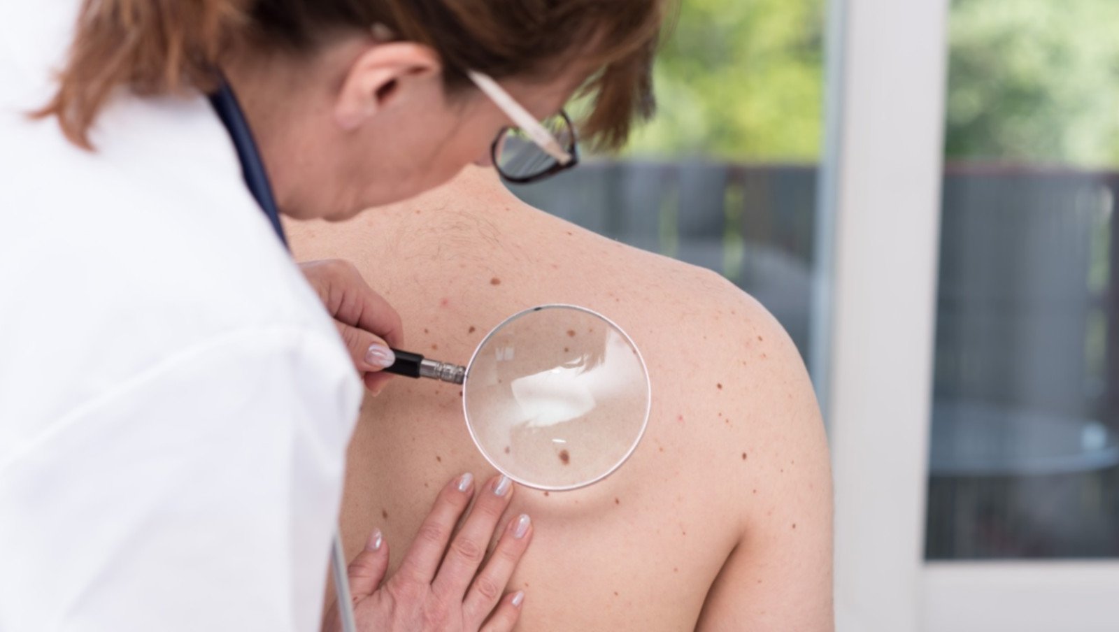Chłoniak skórny T-komórkowy i inne choroby rzadkie z objawami dermatologicznymi....