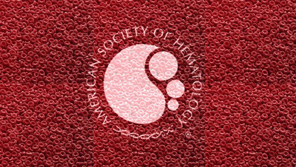 Najciekawsze doniesienia z 59th ASH Annual Meeting 2017 - Szpiczak plazmocytowy