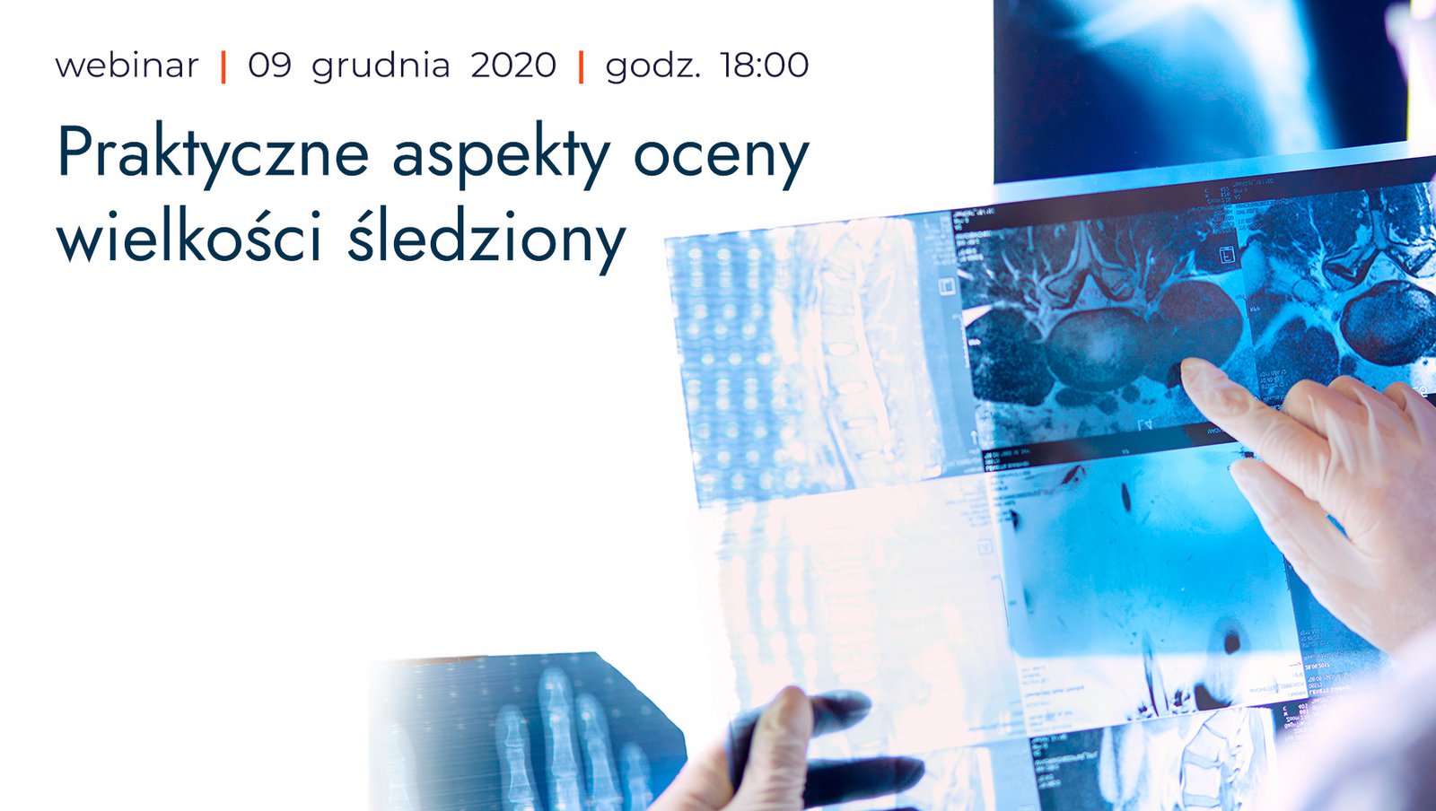 Już dzisiaj. Webinar "Praktyczne aspekty oceny wielkości śledzony".