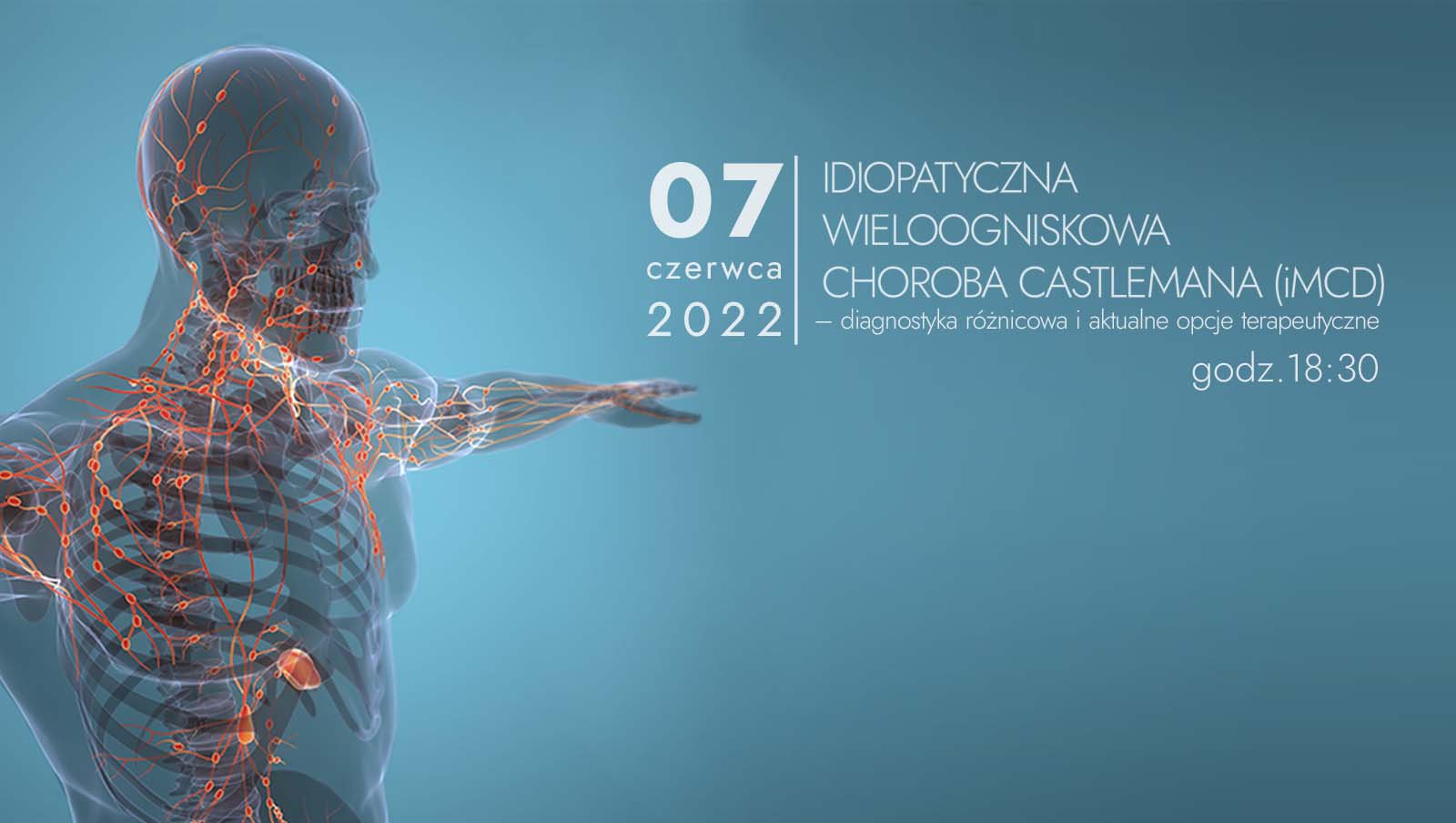 Diagnostyka różnicowa i aktualne opcje terapeutyczne w idiopatycznej wieloogniskowej chorobie Castlemana