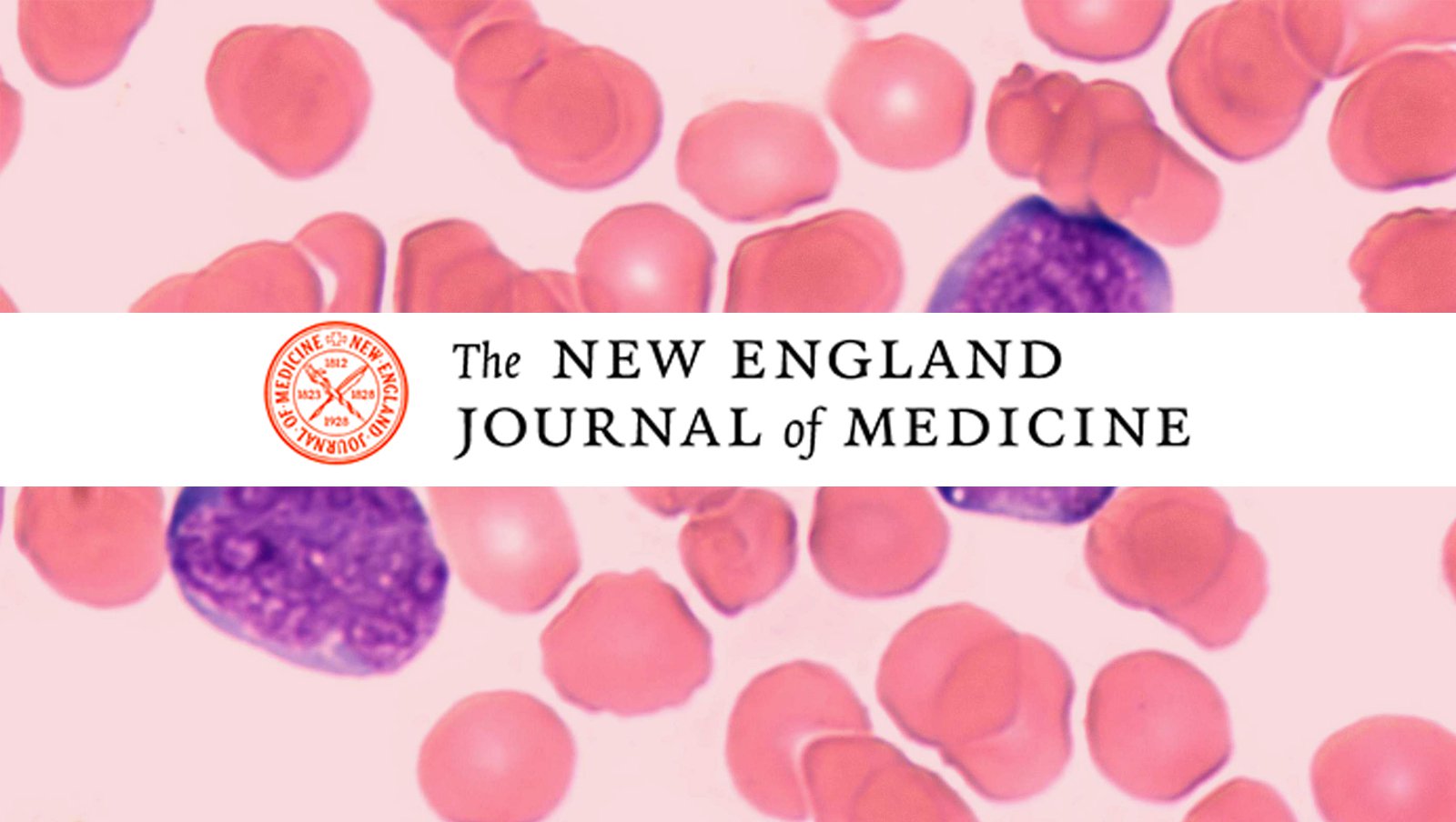 Terapia CAR-T u dorosłych chorych z nawracającym lub opornym na leczenie chłoniakiem rozlanym z dużych komórek B