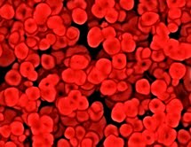 Bezpieczeństwo stosowania czynników stymulujących erytropoezę w zespołach mielodysplastycznych – stale aktualny problem dla hematologów