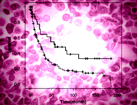 Zrewidowany indeks prognostyczny  IPSS-R dla chorych na MDS