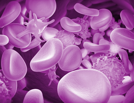 Wytyczne postępowania w hemofilii World Federation of Haemophilia 2013 – co nowego?...