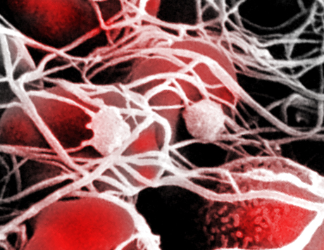 Indukcja tolerancji immunologicznej u dorosłych chorych na hemofilię
