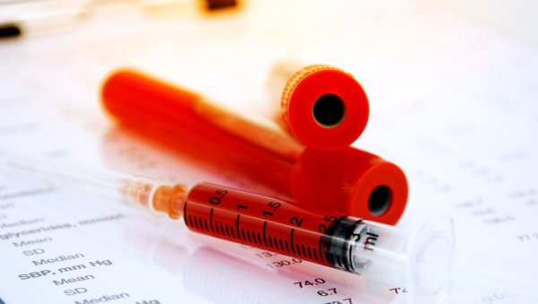 Niskie poziomy witaminy A są związane ze zwiększonym ryzykiem jelitowej postaci GvHD u dzieci