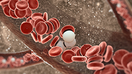 Nosicielki hemofilii A – korelacja genotypu z fenotypem skazy