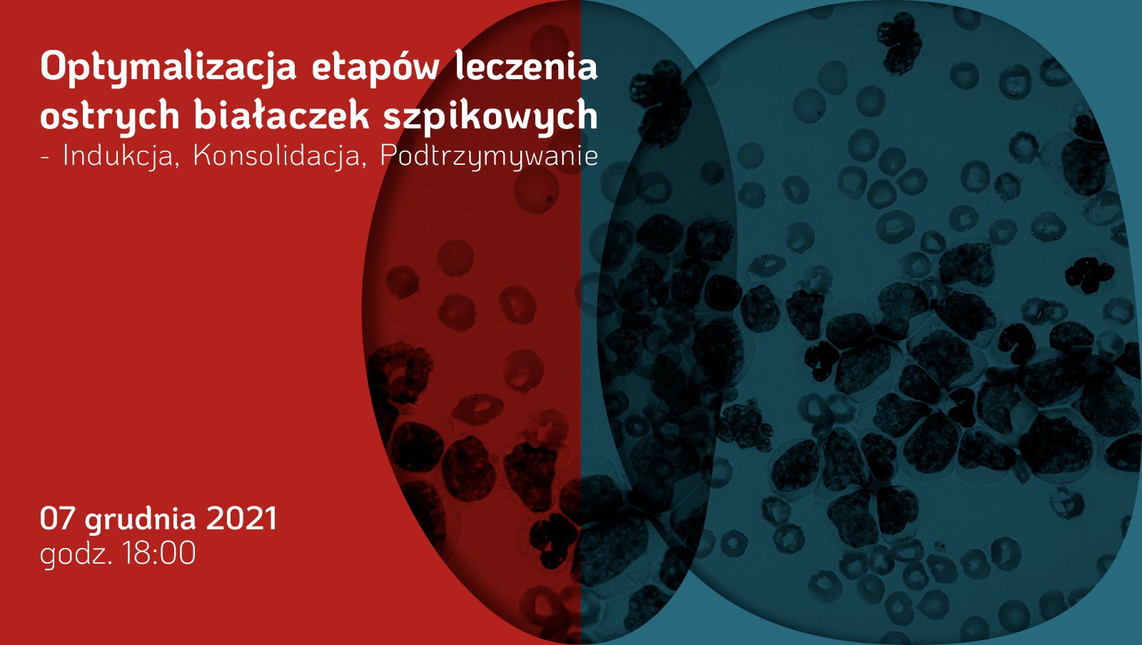 Już jutro webinar „Optymalizacja etapów leczenia ostrych białaczek szpikowych – Indukcja, Konsolidacja, Podtrzymywanie”