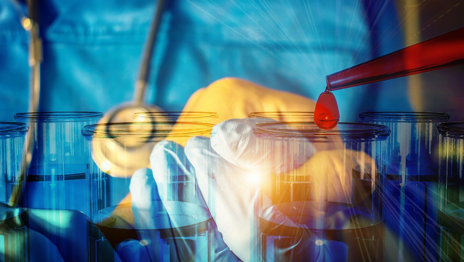 Postępowanie i wskazania do przeszczepienia alogenicznych komórek krwiotwórczych w mielofibrozie. Uaktualnione rekomendacje Międzynarodowej Grupy Roboczej EBMT/ELN