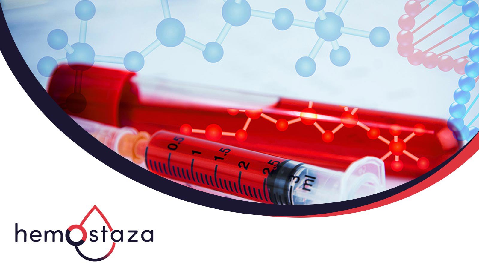 Nabyta zakrzepowa plamica małopłytkowa - stan naglący w hematologii