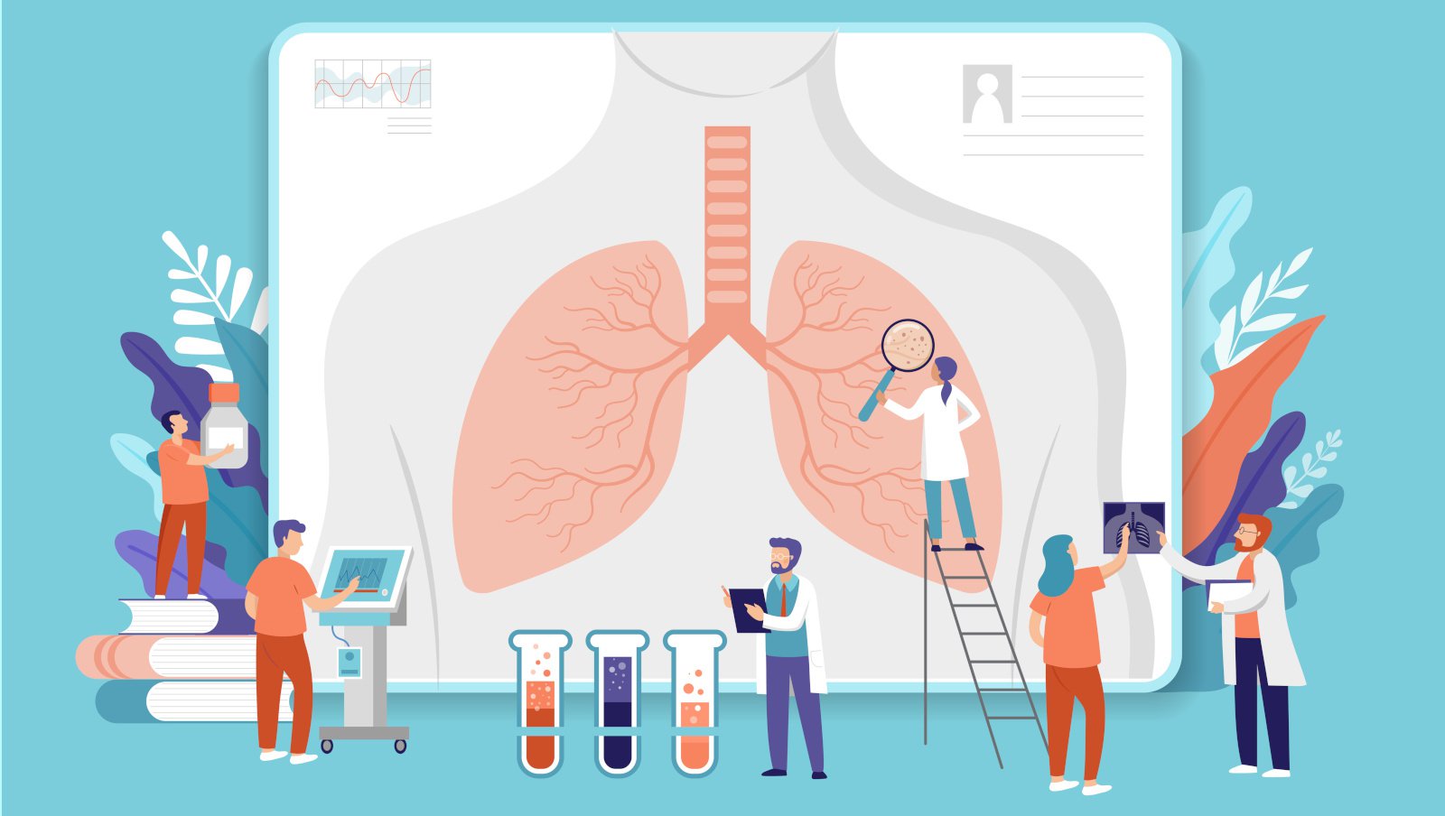 Kryteria ISHLT przewlekłej dysfunkcji alograftu płucnego mają zastosowanie w płucnej przewlekłej chorobie przeszczep-przeciw-gospodarzowi
